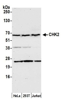 Chk2 Antibody