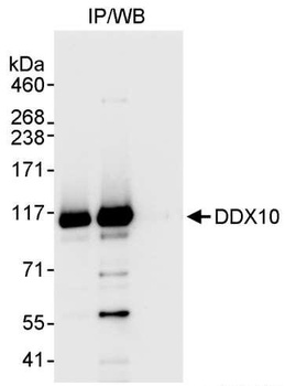 DDX10 Antibody
