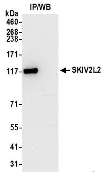 Rabbit anti-SKIV2L2 Antibody