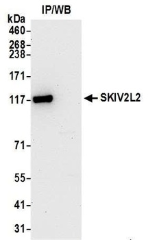 SKIV2L2 Antibody