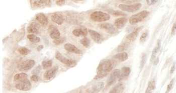 Rabbit anti-AF9 Antibody