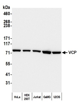 VCP Antibody