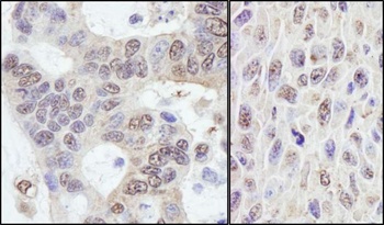Rabbit anti-PRKRIR Antibody