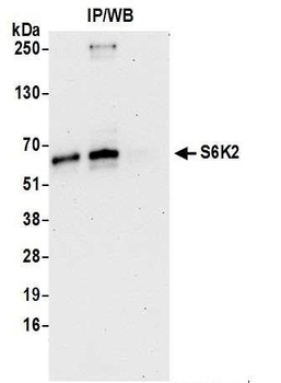 S6K2 Antibody