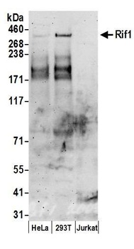 Rabbit anti-RIF1 Antibody