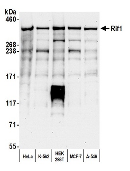 Rabbit anti-RIF1 Antibody