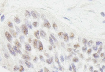 Rabbit anti-RIF1 Antibody