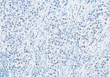 Rabbit anti-RIF1 Antibody