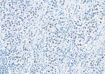 RIF1 Antibody