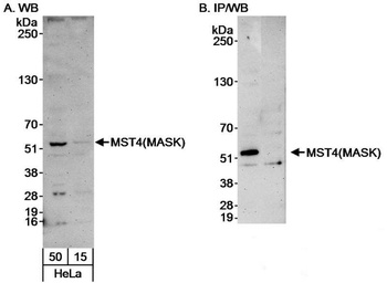Rabbit anti-MST4/MASK Antibody