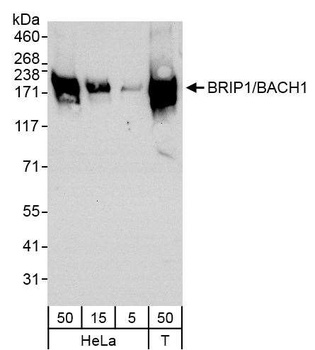 Rabbit anti-BRIP1/BACH1 Antibody