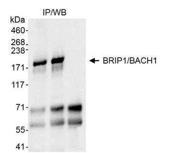Rabbit anti-BRIP1/BACH1 Antibody