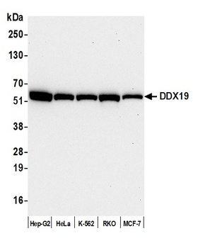 DDX19 Antibody