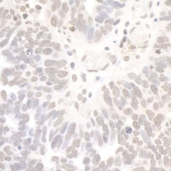 Rabbit anti-REST Antibody