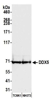 DDX5 Antibody