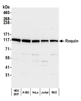 Rabbit anti-Roquin Antibody
