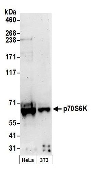 p70S6K Antibody