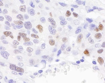 Rabbit anti-RCH1/KPNA2 Antibody