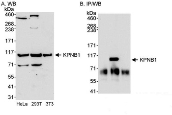 Rabbit anti-KPNB1 Antibody
