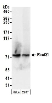 Rabbit anti-RecQ1 Antibody