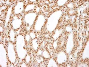 Rabbit anti-RecQ1 Antibody