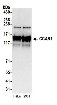 Rabbit anti-CCAR1 Antibody