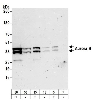 Aurora B Antibody