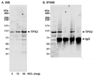 Rabbit anti-TPX2 Antibody