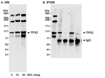 Rabbit anti-TPX2 Antibody