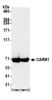 Rabbit anti-CARM1 Antibody