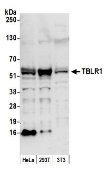TBLR1 Antibody