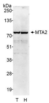 Rabbit anti-MTA2 Antibody