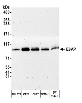 Rabbit anti-E6AP Antibody
