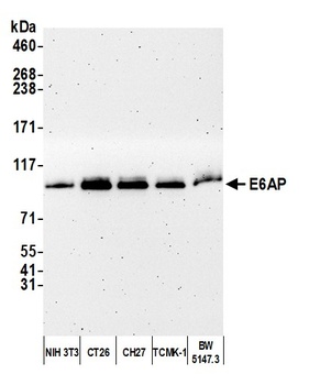 E6AP Antibody