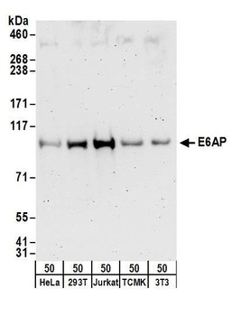 Rabbit anti-E6AP Antibody