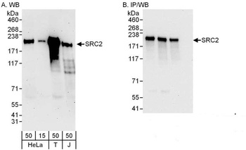 NCOA2/SRC2 Antibody