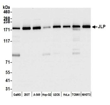 Rabbit anti-JLP Antibody