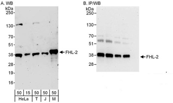 Rabbit anti-FHL2 Antibody