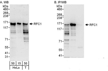 RFC1 Antibody