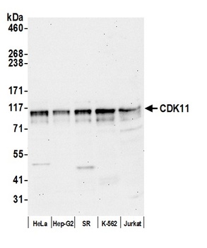 CDK11 Antibody