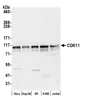 Rabbit anti-CDK11 Antibody