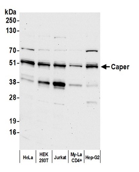 Caper Antibody