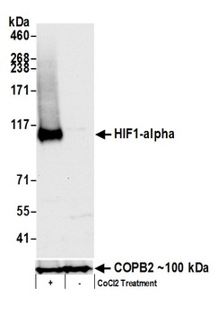 HIF1-alpha Antibody