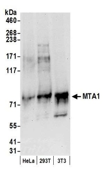 Rabbit anti-MTA1 Antibody