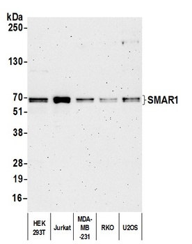 SMAR1/BANP Antibody