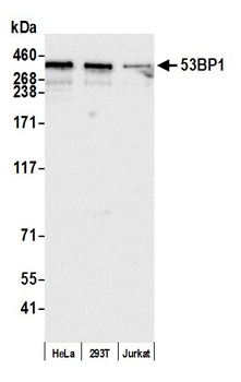 Rabbit anti-53BP1 Antibody