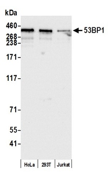 53BP1 Antibody