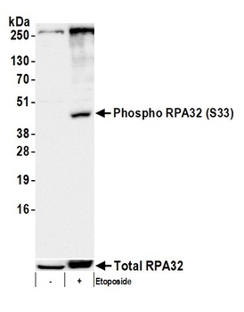 RPA32, Phospho (S33) Antibody