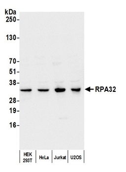 RPA32 Antibody