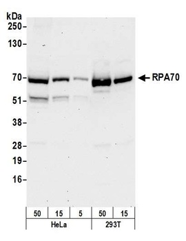 RPA70 Antibody
